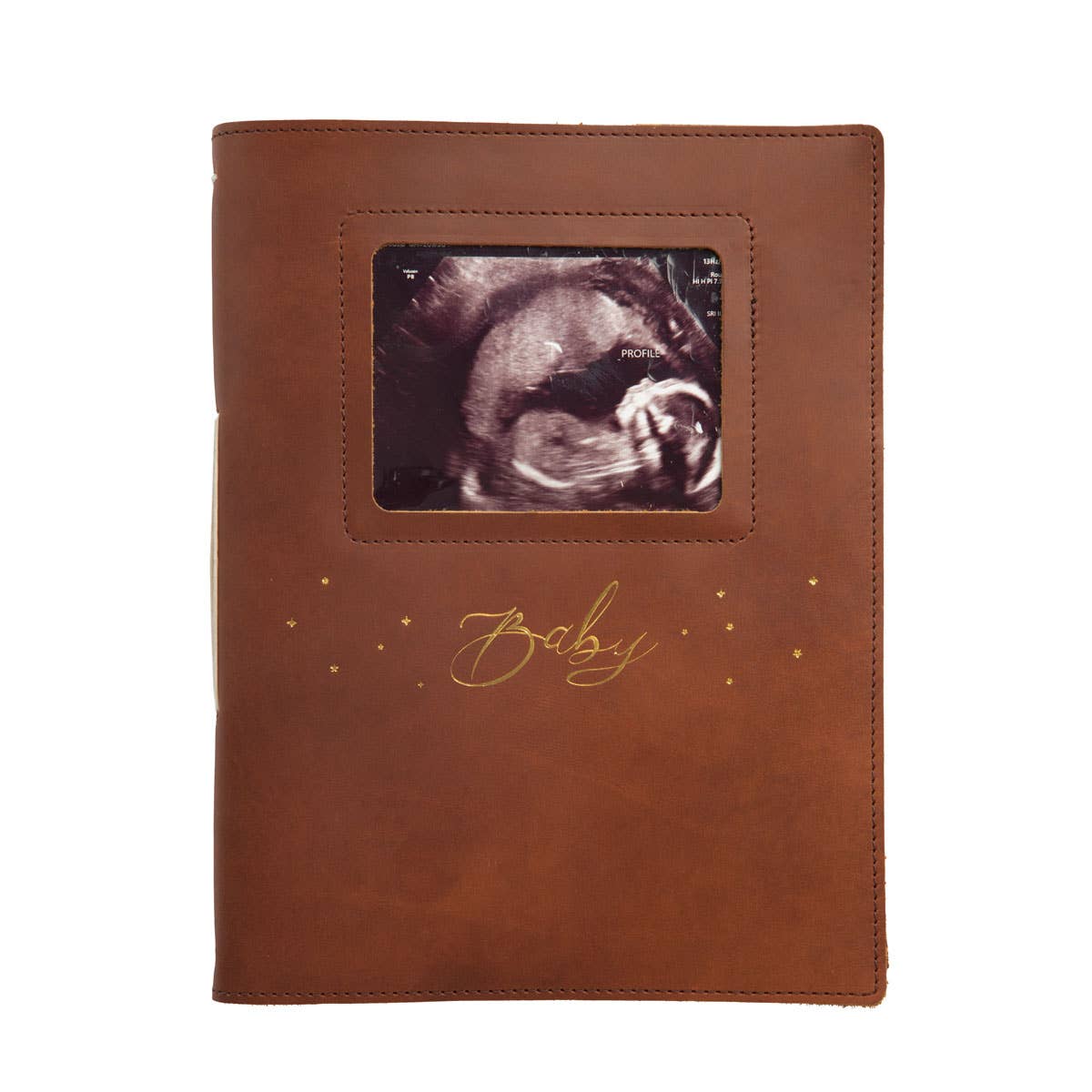 Pregnancy and Baby's First Five Years Leather Journal